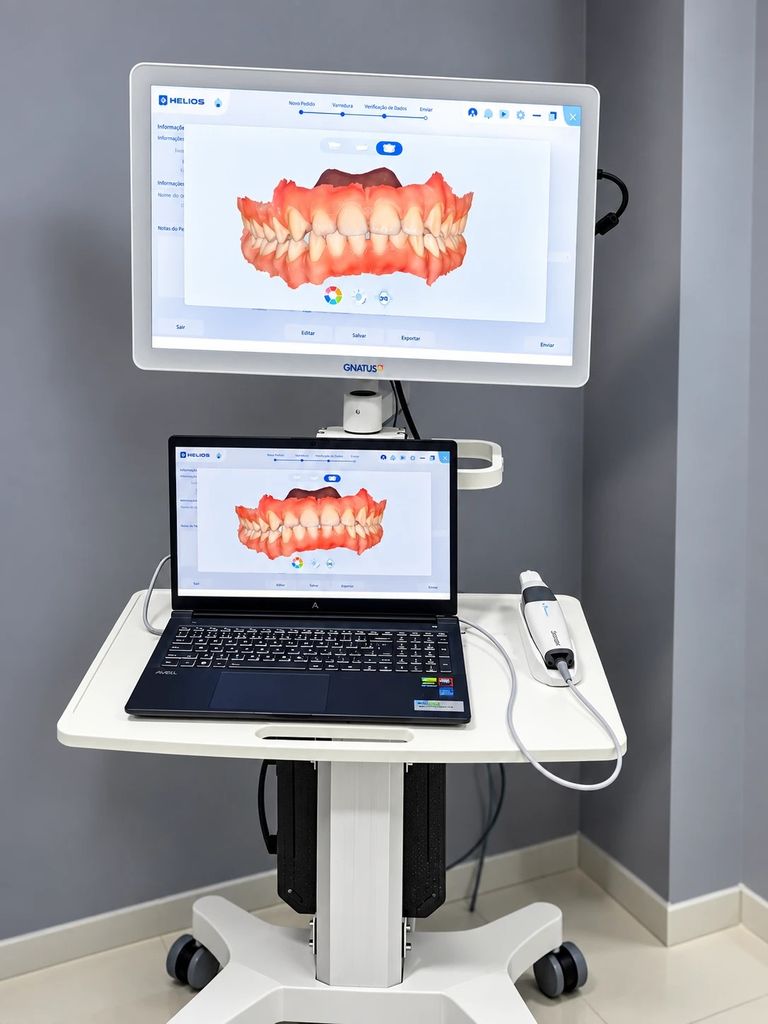 Scanner intraoral da Odontomed Imagem no carrinho móvel, com o modelo 3D das arcadas no monitor e no notebook