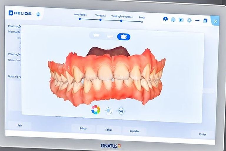 Modelo 3D das arcadas aberto no programa do scanner intraoral